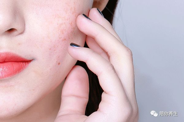 640 - 2026-04-01T163012.620.jpg